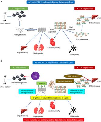 Changing paradigm in the treatment of amyloidosis: From disease-modifying drugs to anti-fibril therapy